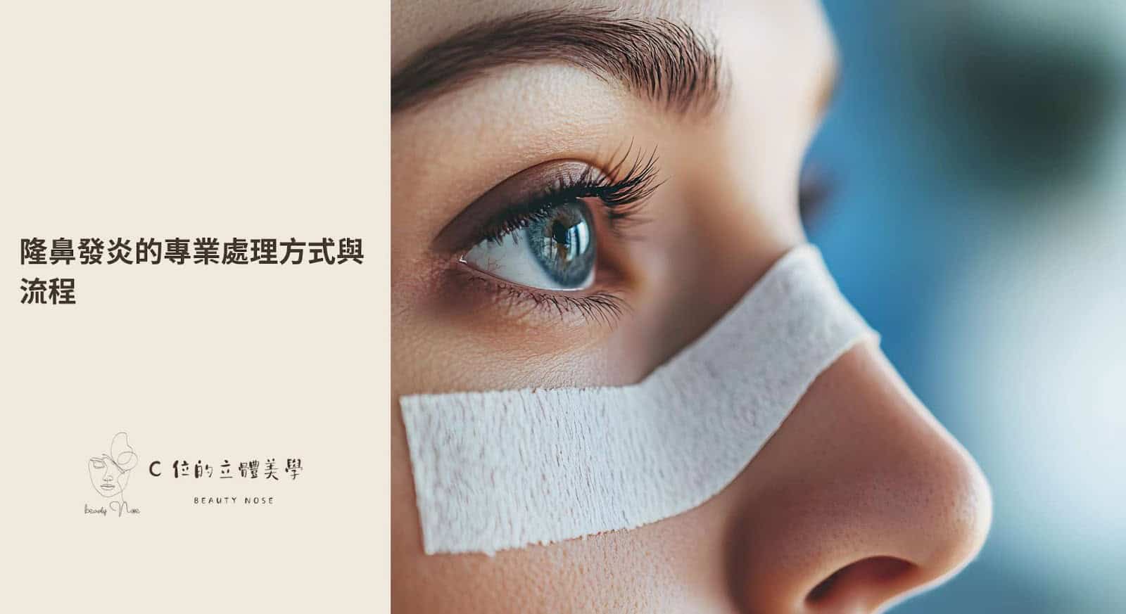 隆鼻發炎的專業處理方式與流程 