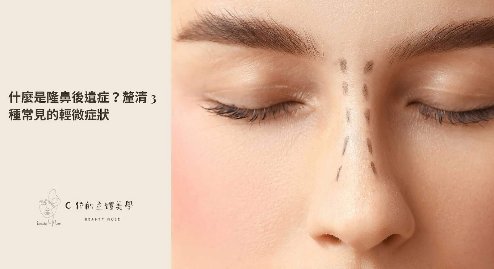 什麼是隆鼻後遺症？釐清 3 種常見的輕微症狀